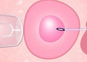 全国试管成功率排名，试管成功率较高的医院名单