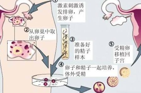 青海无结婚证试管价格表，未婚／单身不同方案对比（2026更新）