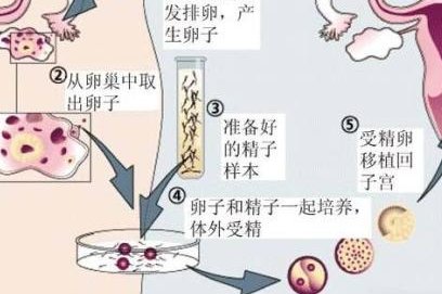 2026年无结婚证做试管要多少钱？聊城市第二人民医院大概要十二万左右