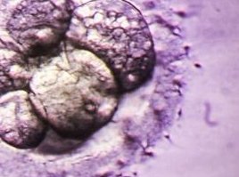 湖南省郴州市哪家医院可以做试管？